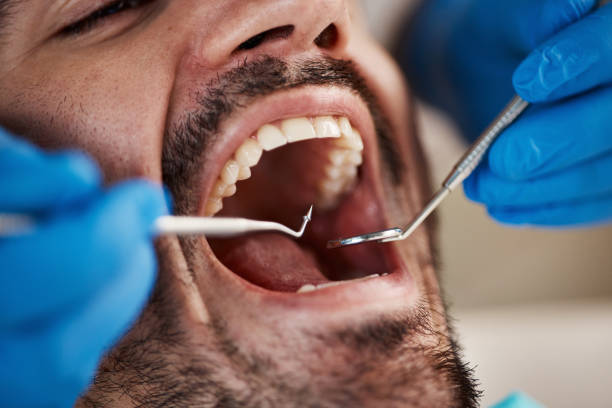 Best Emergency Treatment for Dental Infections or Abscesses in Pine Hills, FL