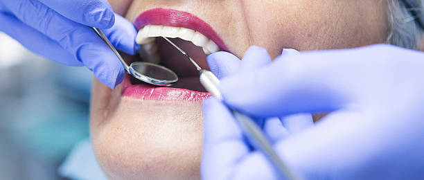 Best Emergency Root Canal Treatment in Pine Hills, FL